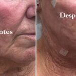 hilos tensores da vinci