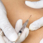 mesoterapia para adelgazar en tarragona