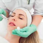 Todo lo que debes saber sobre los tratamientos faciales