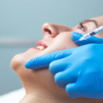 beneficios de la mesoterapia facial