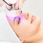 tratamiento láser, mitos y certezas por la doctora Yilian Rigo en Tarragona