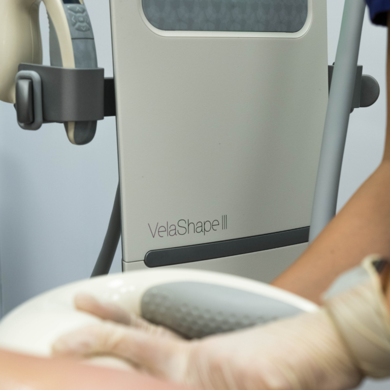 Is Velashape III the best non-invasive body contouring treatment?