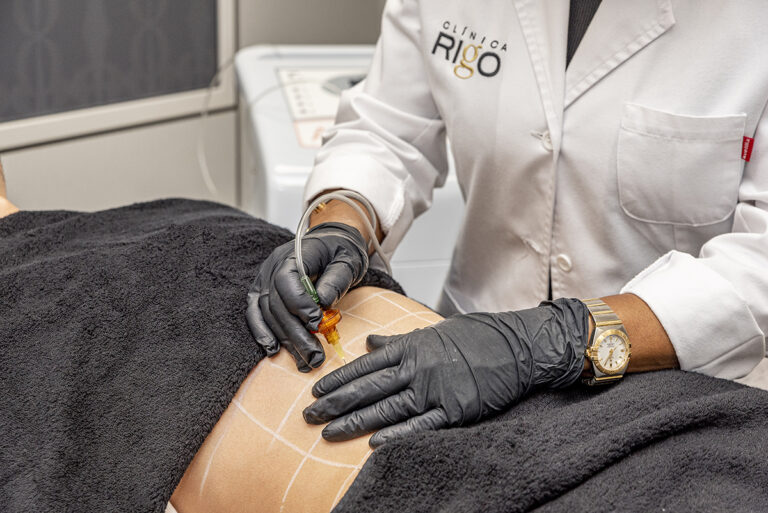 Tratamientos Clinica Rigo