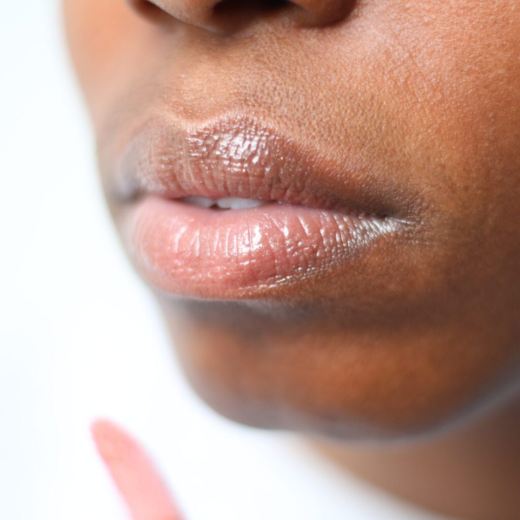 ¿Qué es el ácido hialurónico y cómo funciona en la piel, los labios y los pómulos?