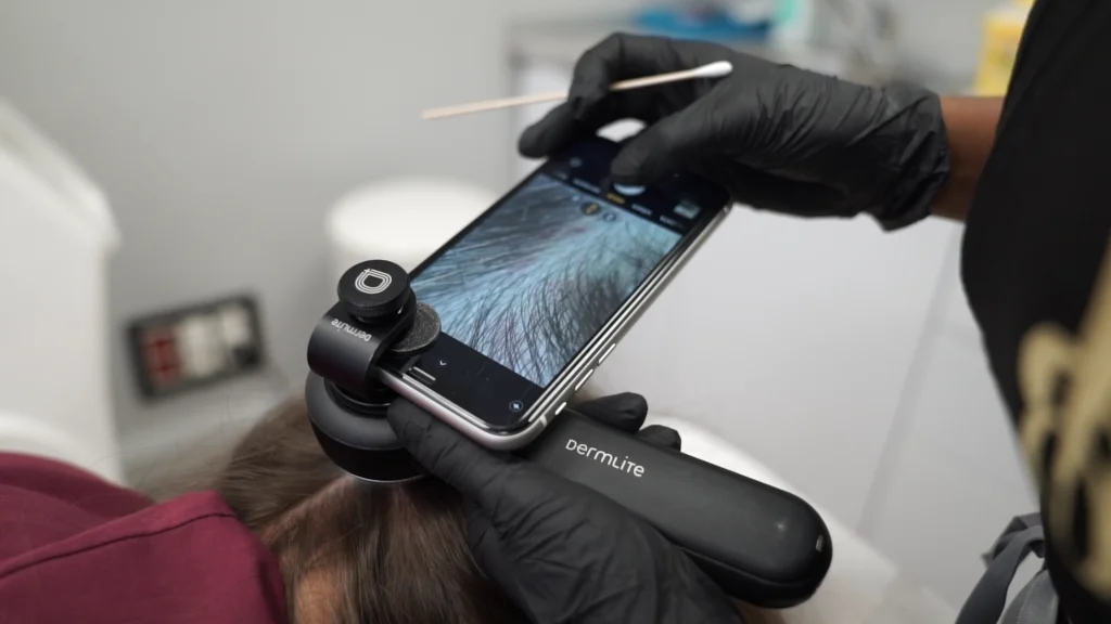 tratamiento para la caída del cabello