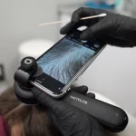 tratamiento para la caída del cabello