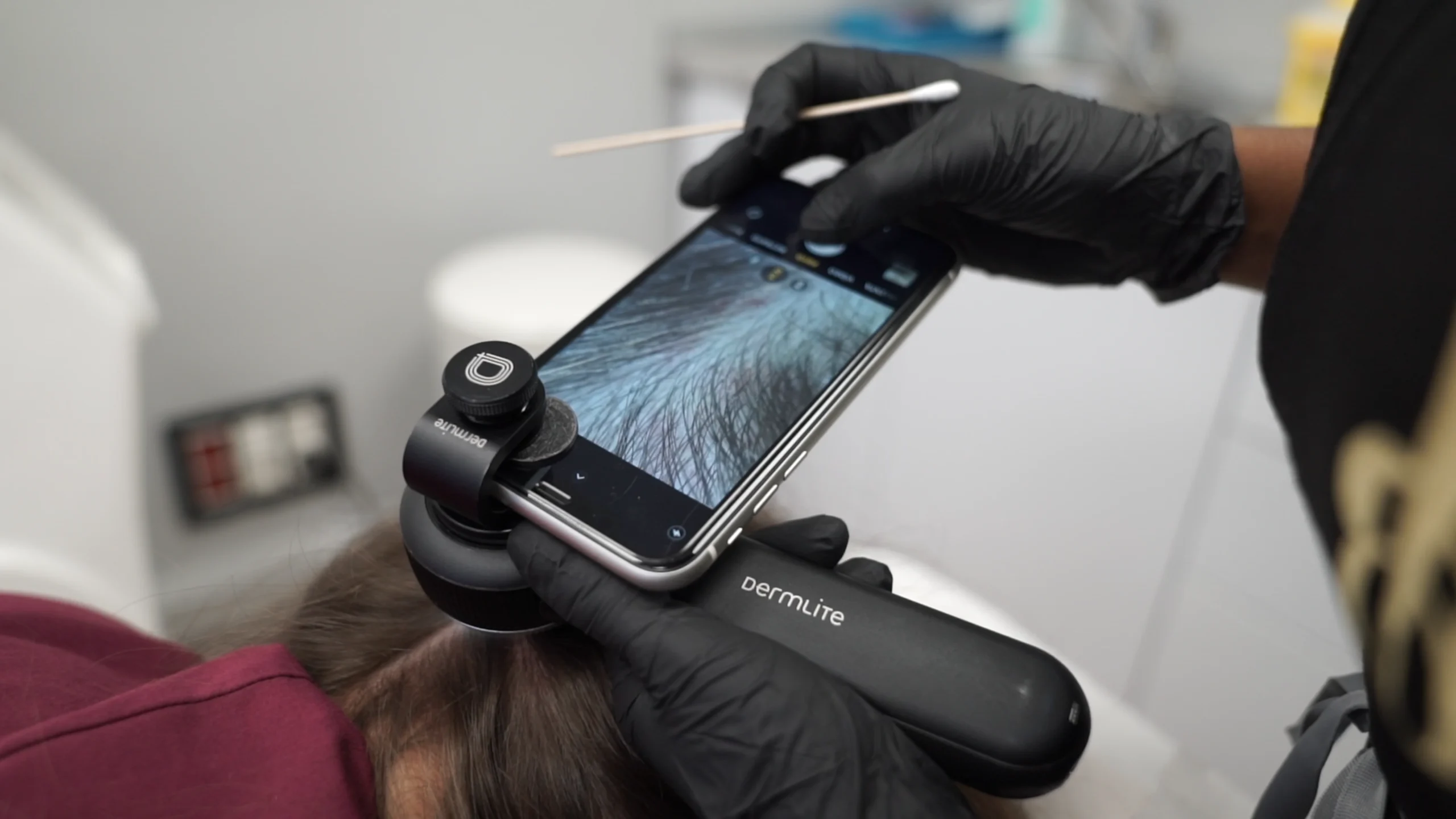 tratamiento para la caída del cabello