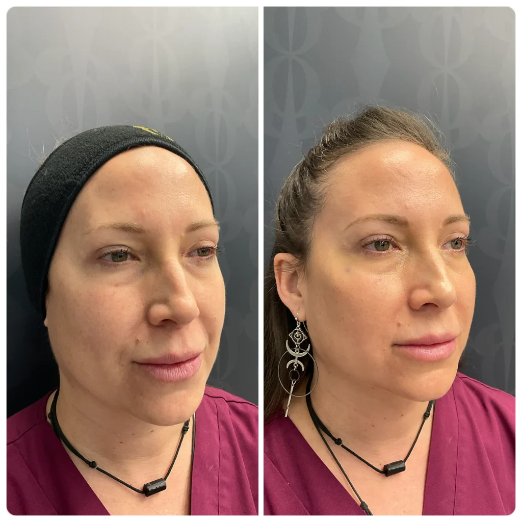 Técnica de los 7 puntos