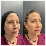 Técnica de los 7 puntos