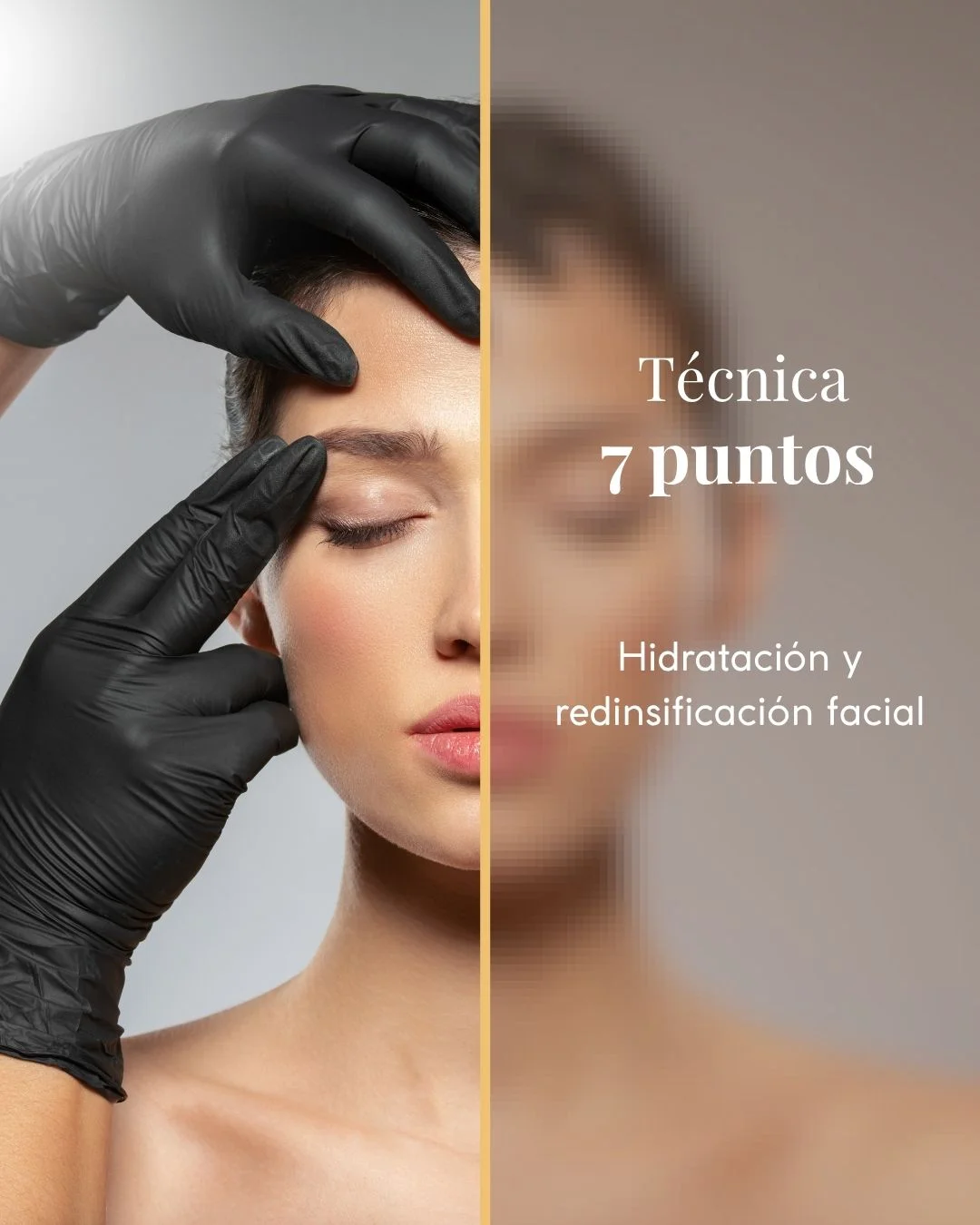 técnica de los 7 puntos