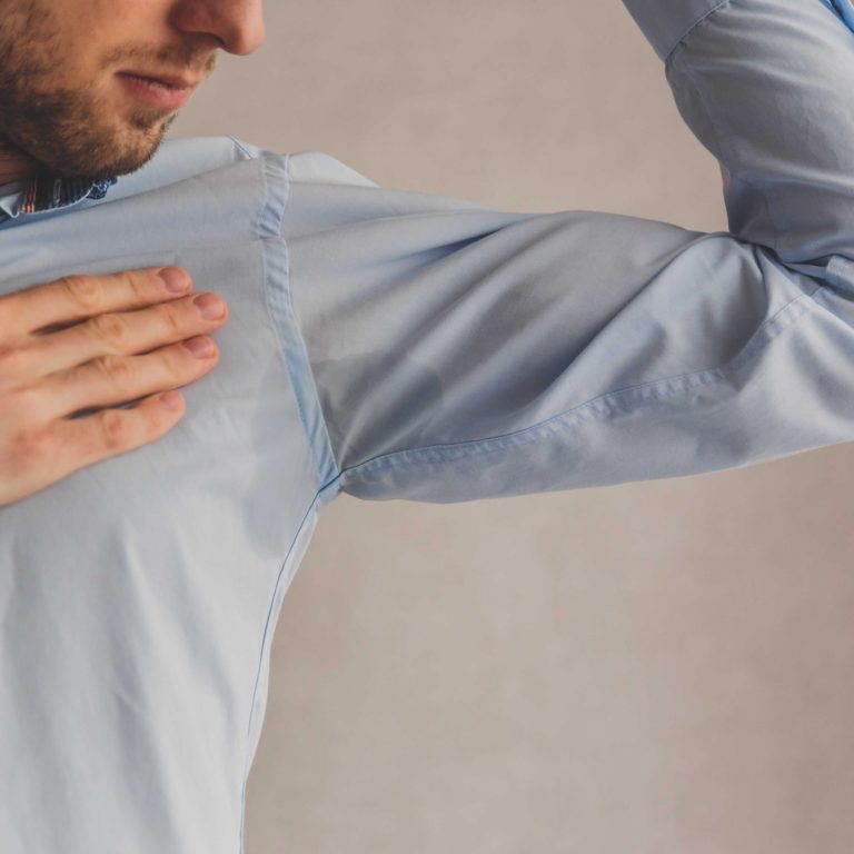 hiperhidrosis