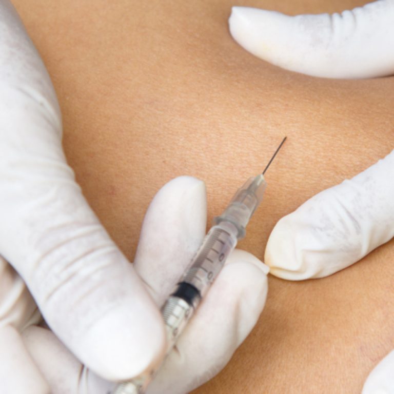 mesoterapia para adelgazar en tarragona