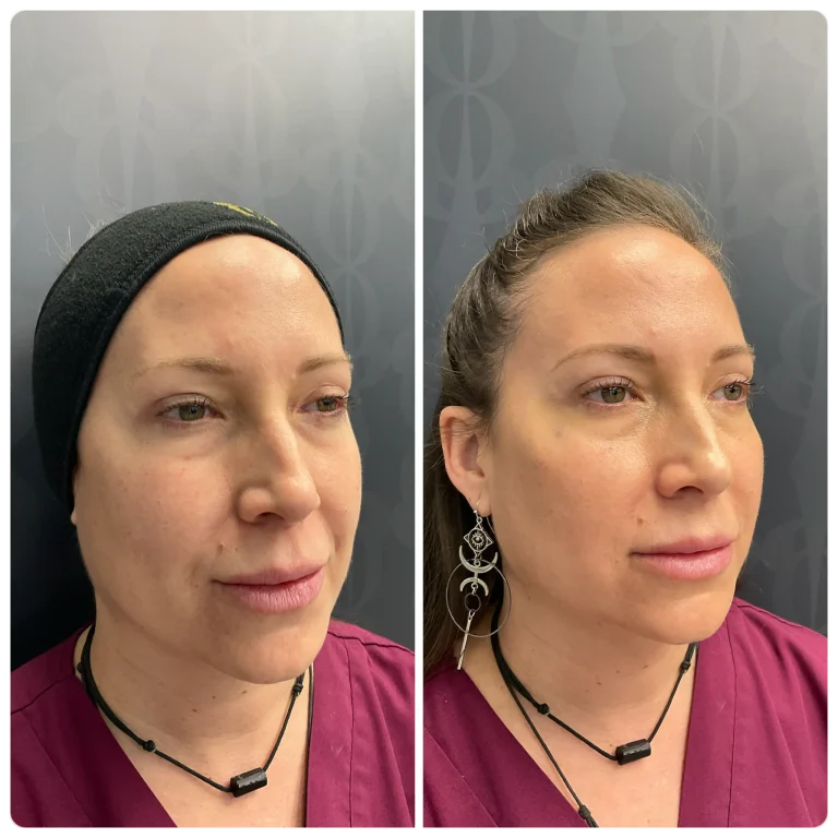 Técnica de los 7 puntos