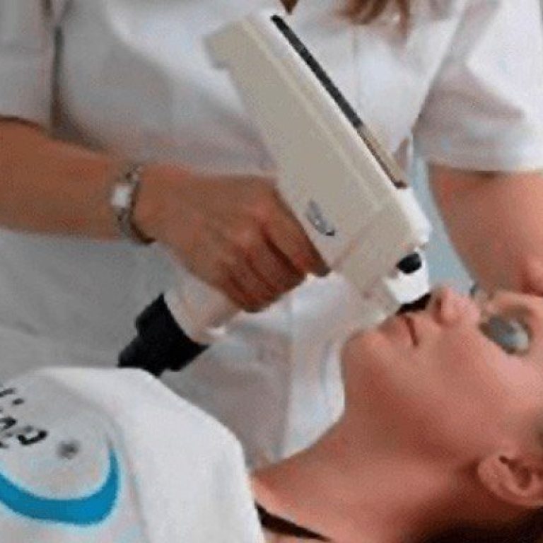 drarigo-noticias-tratamiento-laser-rojeces