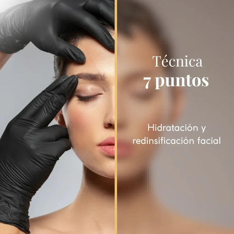 técnica de los 7 puntos